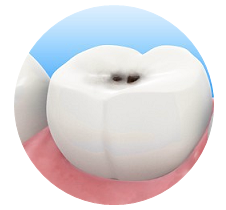 Лечение зубов в Открытой стоматологии